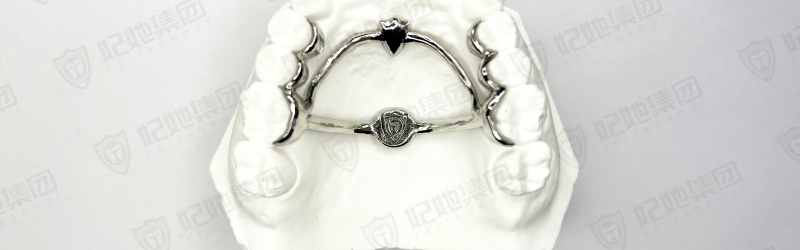 179-1-改良式Nance托+TPA联合（3D一体成型）