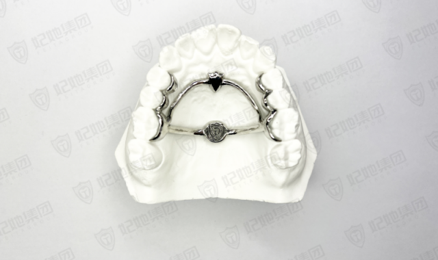 179-1-改良式Nance托+TPA联合（3D一体成型）