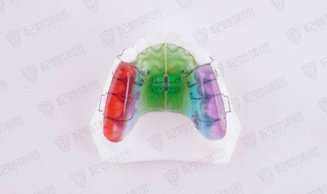 颌垫式螺旋簧横向扩弓矫治器