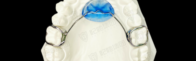 Nance(激光焊接）