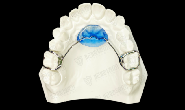 Nance(激光焊接）