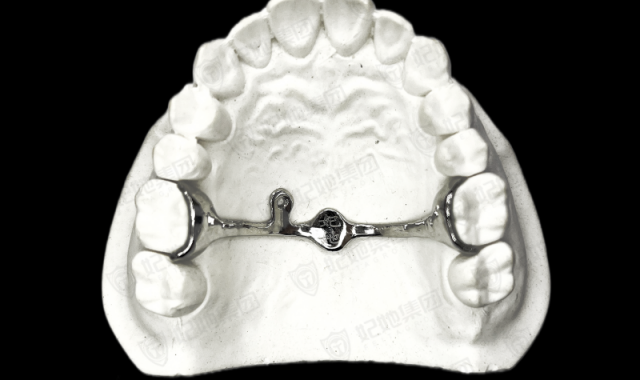 TPA+腭侧钩联合（3D一体成型）