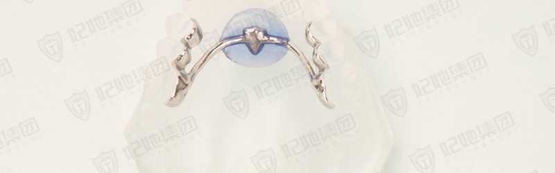 Nance托（3D一体成型）