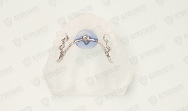 Nance托（3D一体成型）