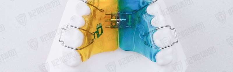 平导式螺旋簧横向扩弓矫治器