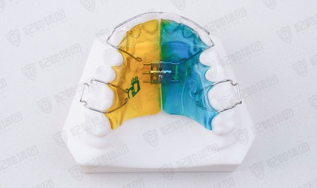 平导式螺旋簧横向扩弓矫治器