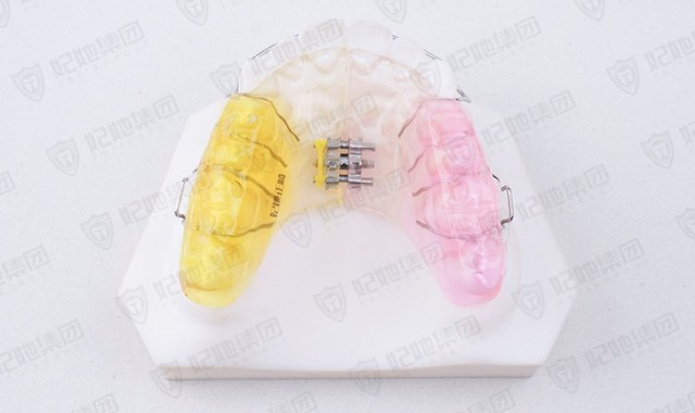 颌垫唇弓式螺旋簧横向扩弓矫治器