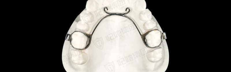 局部牵引式舌弓矫治器（激光焊接）