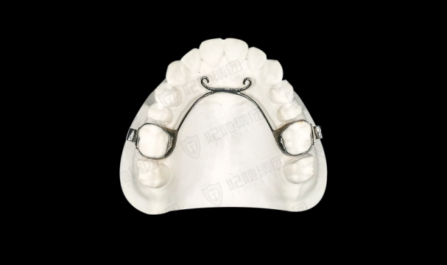 局部牵引式舌弓矫治器（激光焊接）