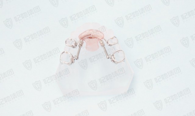 DMG可调式双侧磨牙后移矫治器