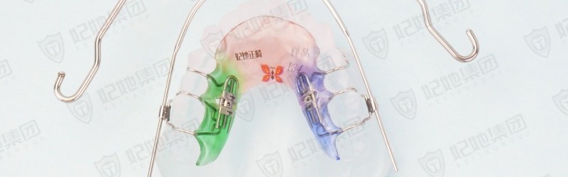 口外弓联合螺旋簧双侧磨牙后移矫治器