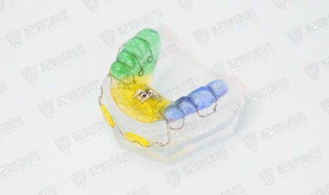 唇挡式三维扩弓矫治器