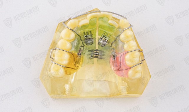 螺旋簧六方扩弓器