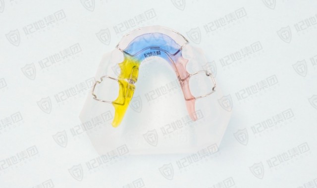 螺旋簧单侧磨牙后移矫治器