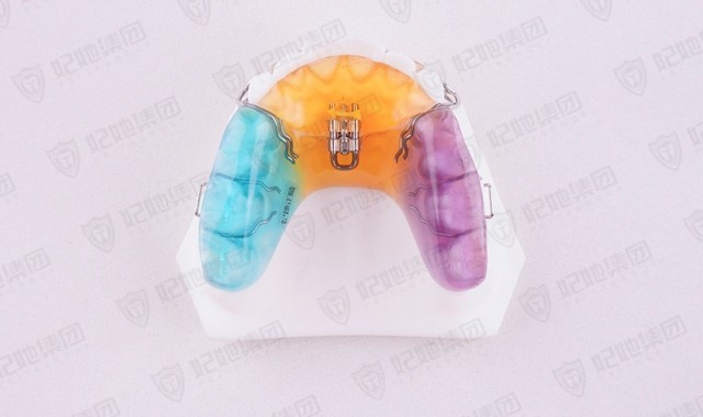 V型螺旋簧前方扩弓矫治器