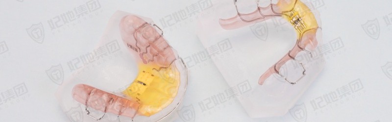 Twin block包胶上颌快扩双阻板矫治器