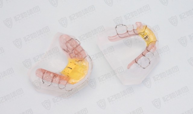 Twin block包胶上颌快扩双阻板矫治器