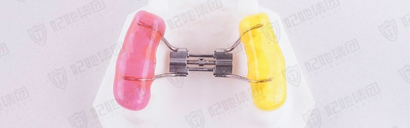 上颌螺旋簧缩弓矫治器
