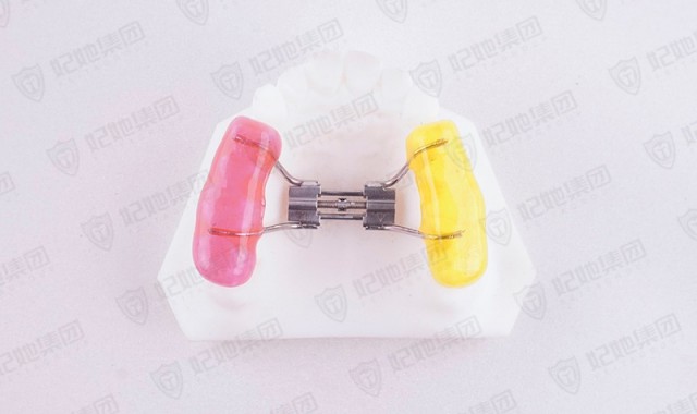 上颌螺旋簧缩弓矫治器