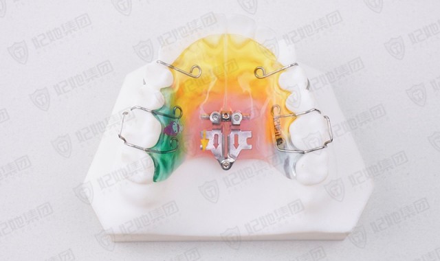 连体式扇形扩弓矫治器