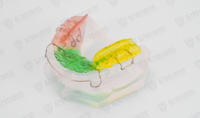 双翼螺旋簧横向扩弓矫治器