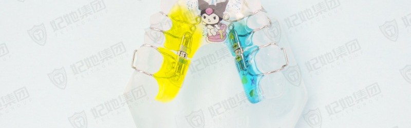 螺旋簧双侧磨牙后移矫治器