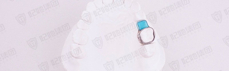 阻萌器 (激光焊接)