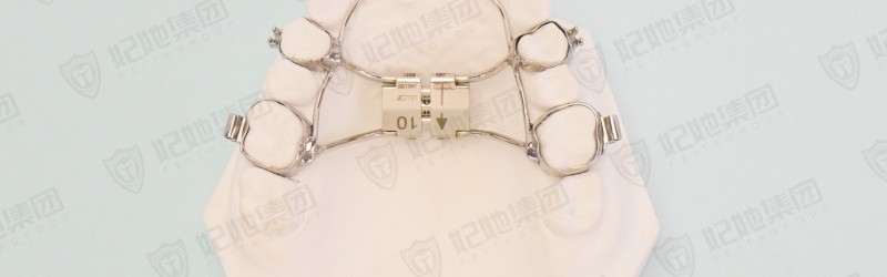 上颌支架式快速扩弓矫治器