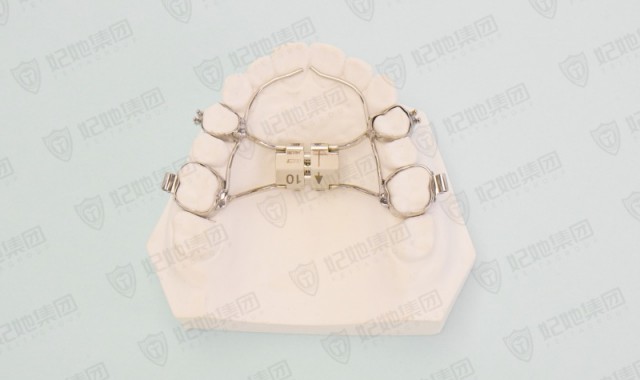 上颌支架式快速扩弓矫治器