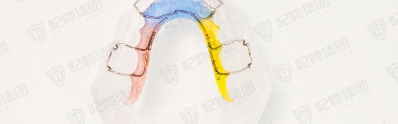 弯制型短刺唇弓(激光焊接)