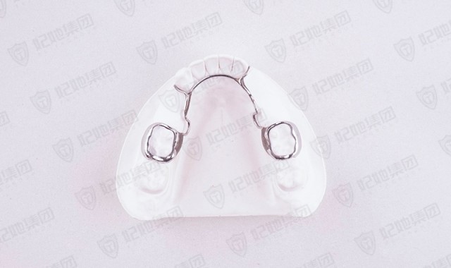 辅丝式舌弓缺隙保持器(激光焊接)  