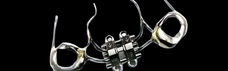 支抗钉骨性扩弓矫治器