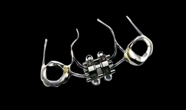 支抗钉骨性扩弓矫治器