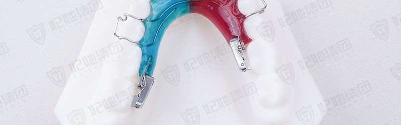 螺旋簧双侧磨牙竖立器 