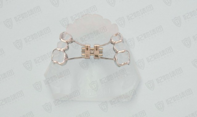 上颌支架式快速扩弓矫治器