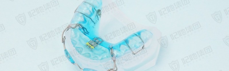 唇挡前牵式V字型前方扩弓矫治器