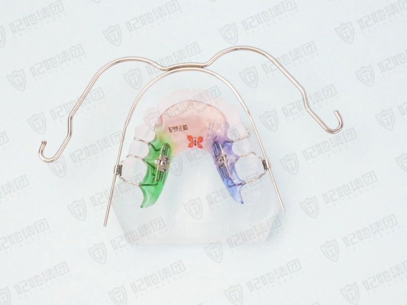079-口外弓联合螺旋簧双侧磨牙后移矫治器.jpg