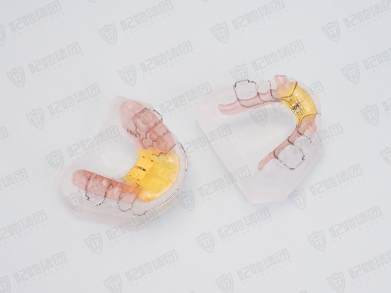 153-Twin block包胶上颌快扩双阻板矫治器.jpg